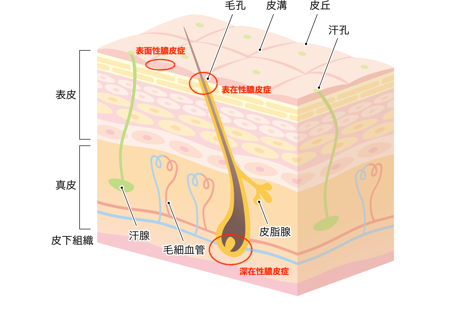 犬の膿皮症 原因と症状から診断と治療まで